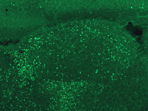 Nicotinamide: A Way to Prevent Fetal Alcohol Syndrome? Nicotinamide: A Way to Prevent Fetal Alcohol Syndrome?