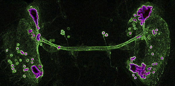 Signals That Tell Fly Neurons to Extend or Retract Signals That Tell Fly Neurons to Extend or Retract