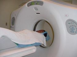 I-ELCAP study: Lung cancer can be detected early with annual low-dose CT screening