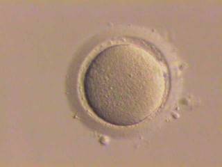 How IVF could be causing genetic errors in embryos