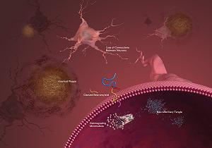 Isoflurane may produce Alzheimer's-like changes in the brain