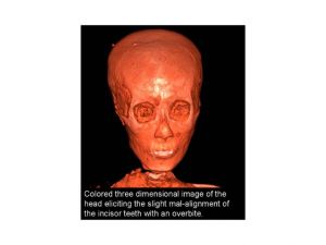 Inside the Head of an Ancient Pharaoh