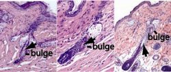 First Demonstration of New Hair Follicle Generation