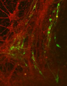 Enhancing activity of marijuana-like chemicals in brain may treat Parkinson's Disease